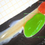 Malformation Detection