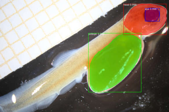 AI for malformation detection