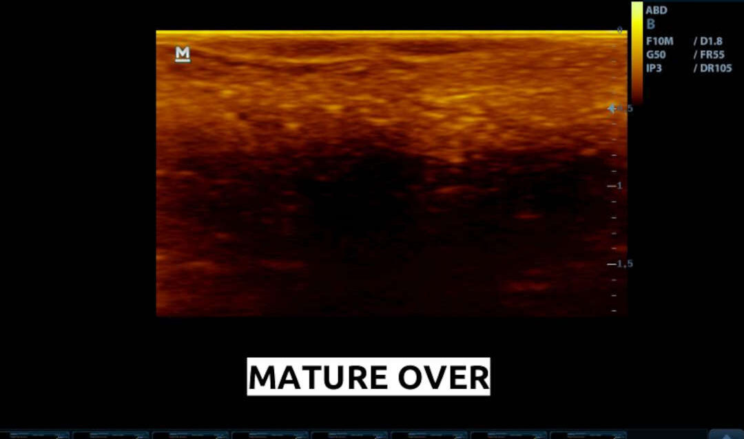 an ultra sound scan of a female frog recorded with an old Mindray scanner