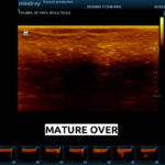 AQUASCAN™: Enhancing Scanners for Image Recognition