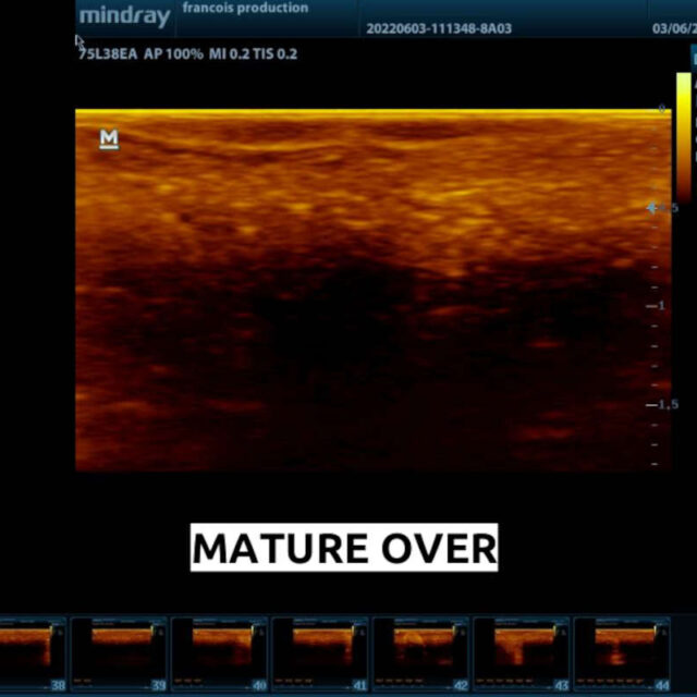 an ultra sound scan of a female frog recorded with an old Mindray scanner