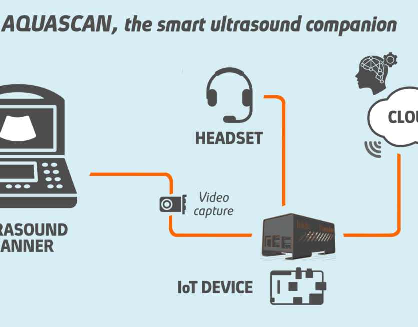 Operatin pattern of AQUASCAN, the smart ultrasound companion